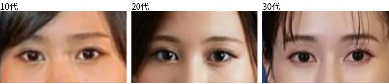 前田敦子 目元 変化 目頭切開疑惑